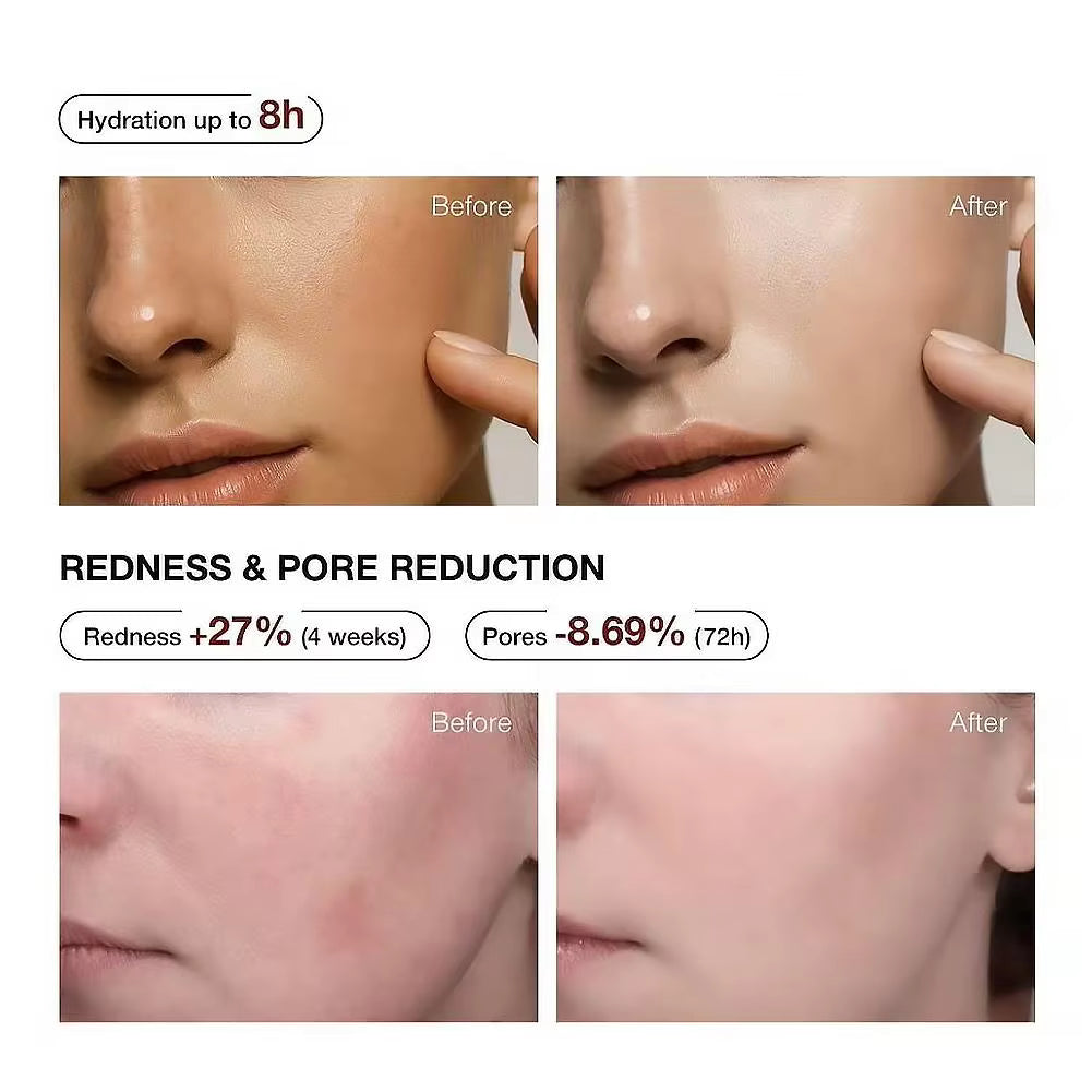 Teashell 5% Niacinamide & Arbutin Dark Spot Serum