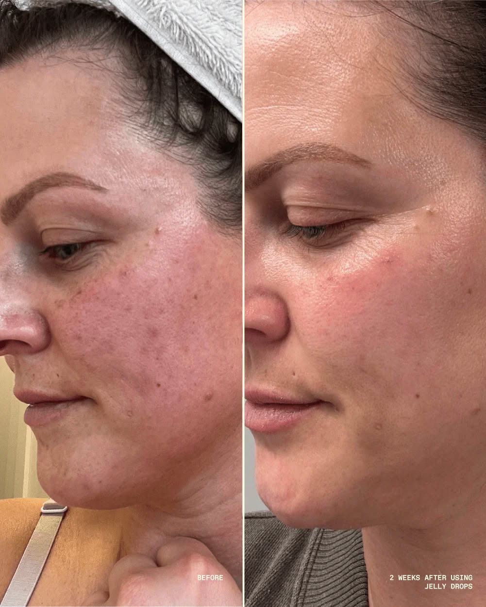 Madeca Anti-Aging Reverse Cream
