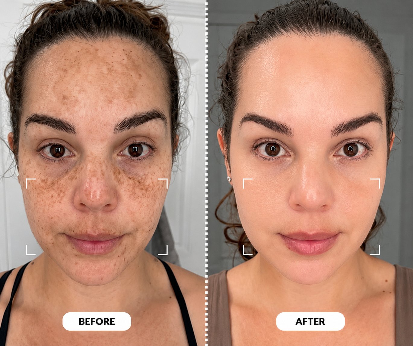 Turmeric Dark Spot & Hyperpigmentation Eraser Pads