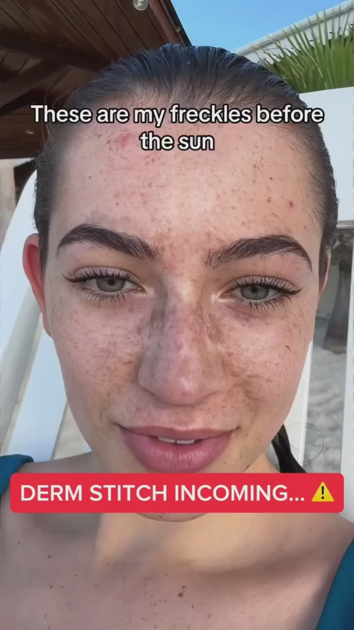 Turmeric Dark Spot & Hyperpigmentation Eraser Pads