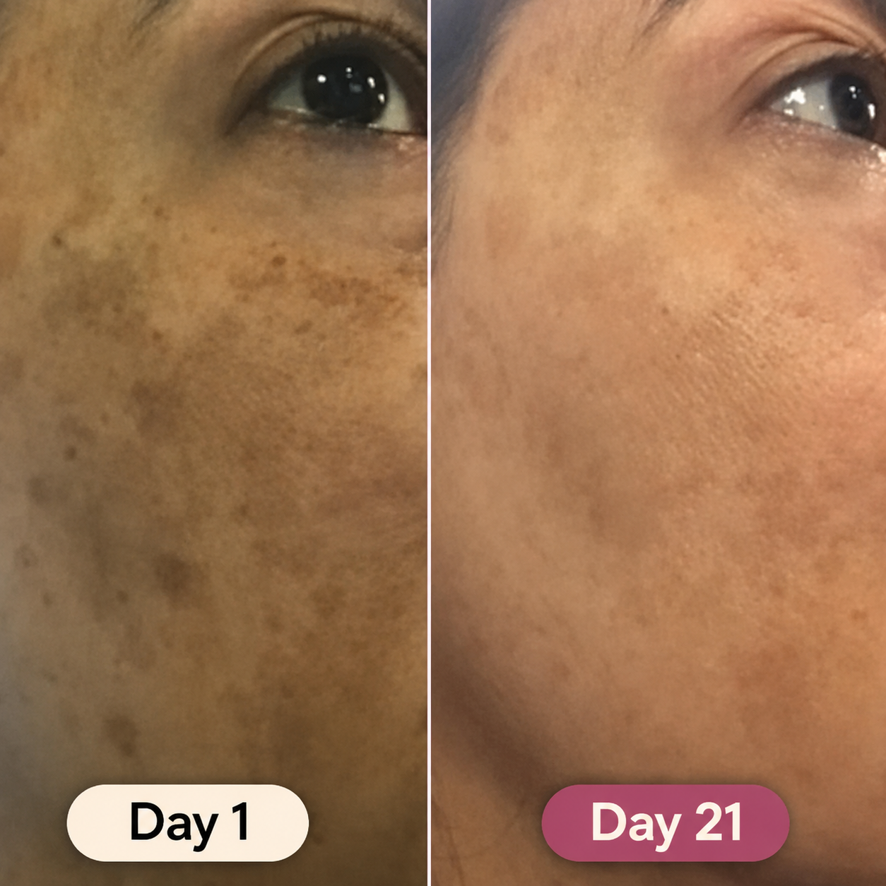 Turmeric Dark Spot & Hyperpigmentation Eraser Pads